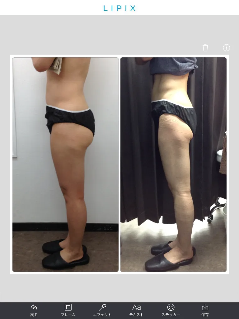 ヤセにつながる日常生活の意外なおすすめ