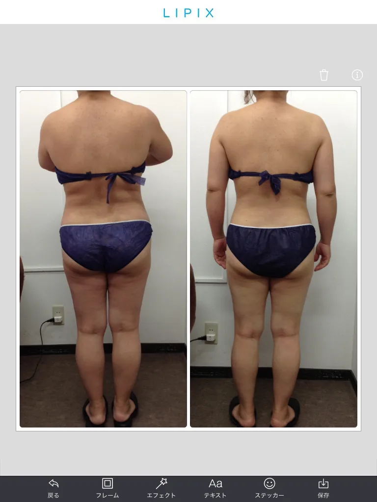 東海市・蟹江町で痩せたい方！結果重視の痩身エステの選び方。